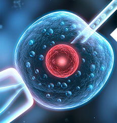 单精子卵胞浆显微注射